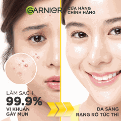 Sữa Rửa Mặt Garnier 3 Trong 1 Ngừa Mụn 100ml (Mới) Bright Complete Anti-Acne Cleansing Foam
