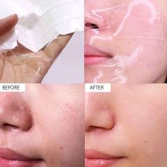 Mặt Nạ Celderma Ninetalks Màu Hồng 30g ( 4 Miếng )