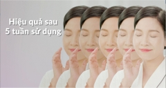 Viên Uống Chống Nắng Trắng Da Edally (Edally Royal Skin Whitening UV Care Pill)