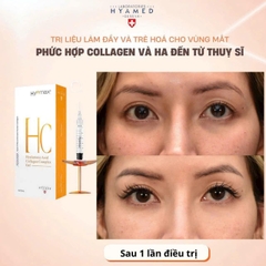 HYAMAX HC HYALURONIC ACID COLLAGEN COMPLEX GEL / CHẤT LÀM ĐẦY VÀ TRẺ HÓA VÙNG MẮT