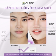 CUREA SOFT / FILLER FILLER TIÊM TẠO HÌNH MÔI, XÓA NẾP GẤP SÂU BỀN VỮNG