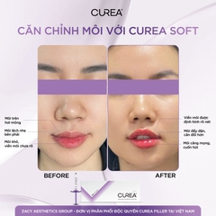 CUREA SOFT / FILLER FILLER TIÊM TẠO HÌNH MÔI, XÓA NẾP GẤP SÂU BỀN VỮNG