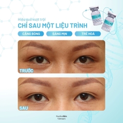 NUCLEOSKIN / ĐỈNH CAO TÁI CẤU TRÚC SINH HỌC VÀ PHỤC HỒI DA TẬN GỐC TẾ BÀO 