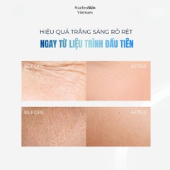 NUCLEOSKIN / ĐỈNH CAO TÁI CẤU TRÚC SINH HỌC VÀ PHỤC HỒI DA TẬN GỐC TẾ BÀO 