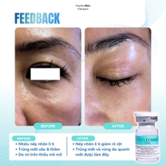NUCLEOSKIN / ĐỈNH CAO TÁI CẤU TRÚC SINH HỌC VÀ PHỤC HỒI DA TẬN GỐC TẾ BÀO 
