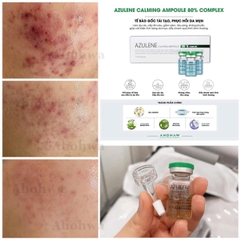 AZULENE CALMING AMPOULE 80% COMPLEX / TẾ BÀO GỐC TÁI TẠO & PHỤC HỒI DA MỤN 