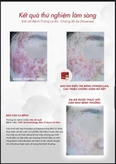 PORZELLAN SKIN GLAZER: Bí Quyết Tái Sinh Làn Da Căng Bóng, Khỏe Mạnh Từ Sâu Bên Trong
