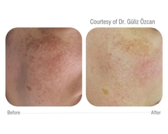 CELLBOOSTER® GLOW: Phức Hợp Tái Tạo Da Chuyên Sâu, Đánh Bay Sạm Nám và Căng Bóng Tức Thì