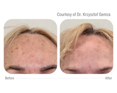 CELLBOOSTER® GLOW: Phức Hợp Tái Tạo Da Chuyên Sâu, Đánh Bay Sạm Nám và Căng Bóng Tức Thì