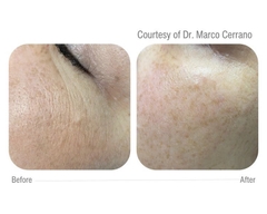 CELLBOOSTER® GLOW: Phức Hợp Tái Tạo Da Chuyên Sâu, Đánh Bay Sạm Nám và Căng Bóng Tức Thì