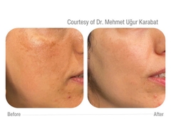 CELLBOOSTER® GLOW: Phức Hợp Tái Tạo Da Chuyên Sâu, Đánh Bay Sạm Nám và Căng Bóng Tức Thì