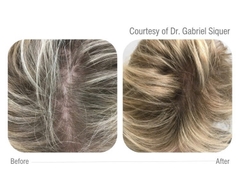 CELLBOOSTER® HAIR: Công Nghệ CHAC Phục Hồi Nang Tóc, Kích Thích Mọc Tóc Chuyên Sâu