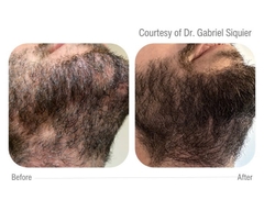 CELLBOOSTER® HAIR: Công Nghệ CHAC Phục Hồi Nang Tóc, Kích Thích Mọc Tóc Chuyên Sâu