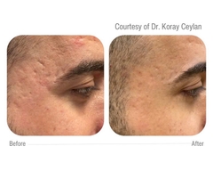 CELLBOOSTER® LIFT: Bí Mật Nâng Cơ & Tái Sinh Làn Da Sâu Từ Bên Trong Với Công Nghệ CHAC Độc Quyền