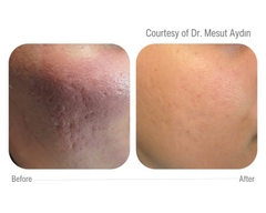 CELLBOOSTER® LIFT: Bí Mật Nâng Cơ & Tái Sinh Làn Da Sâu Từ Bên Trong Với Công Nghệ CHAC Độc Quyền
