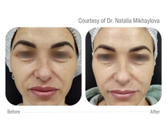 CELLBOOSTER® LIFT: Bí Mật Nâng Cơ & Tái Sinh Làn Da Sâu Từ Bên Trong Với Công Nghệ CHAC Độc Quyền