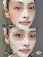 MẶT NẠ ĐẤT SET  KIEHL'S MINI SIZE 14ML