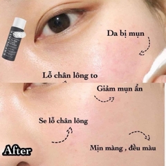 Tdc hoá học Paula’s choice 2% BHA - 30ml