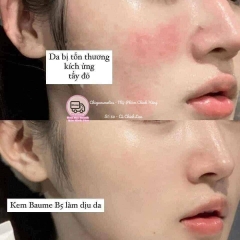 Kem dưỡng phục hồi B5 Ciracle