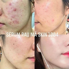 Serum Centella 100ml