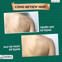 Sữa tắm trị mụn Somebymi 400gr