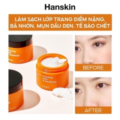 Sáp Tẩy Trang Hanskin AHA Cleansing Balm & Blackhead hũ 80gr