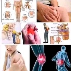 Thuốc trị đau nhức xương khớp Thái Lan NOXA 20 hộp 1 vỉ 10 viên