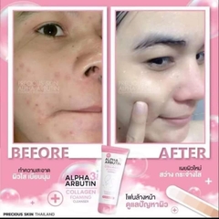 Sữa rửa mặt Alpha Arbutin+3 Thái Lan