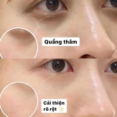 Kem trị thâm quầng mắt và bọng mắt Yanhee Eye Gel Thái Lan