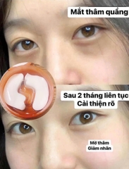 Mặt nạ mắt Vitano C huyết thanh hộp 60 miếng