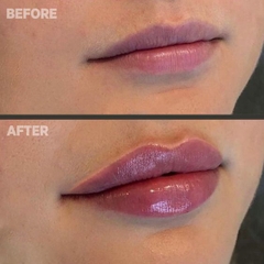 FILLER