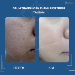 TINH CHẤT VI SINH 2.7