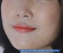 KEM DƯỠNG TRẮNG GLACIER BRIGHTENING CREAM