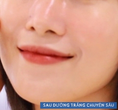 KEM DƯỠNG TRẮNG GLACIER BRIGHTENING CREAM
