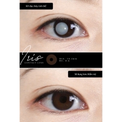[LOẠI TỐT] Lens thẩm mỹ che khuyết điểm Angel Eyes dành cho mắt bị đục thủy tinh thế, kéo mây, cườm - GSLENS
