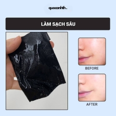 Mặt Nạ Mediheal Solution Mask