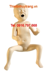 Mô Hình Cơ Thể Trẻ Sinh Non 24 Tuần Tiên Tiến GD/FT331A