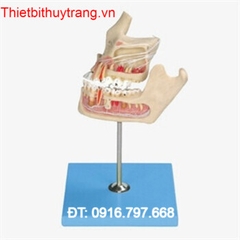 MÔ HÌNH GIẢI PHẪU BỆNH LÝ RĂNG CÓ HÀM GD/B10016