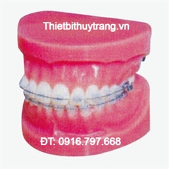 MÔ HÌNH GIẢI PHẪU CHỈNH NHA CỐ ĐỊNH GD/B10036