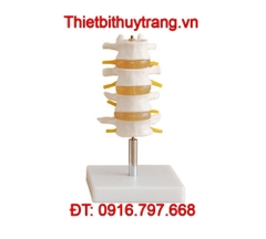 MÔ HÌNH GIẢI PHẪU ĐỐT XƯƠNG SỐNG THẮT LƯNG 4 CHIẾC TT-118