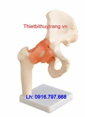 Mô Hình Giải Phẫu Khớp Hông