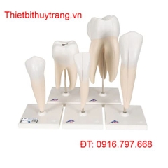 BỘ MÔ HÌNH RĂNG NGƯỜI CLASSIC SERIES 5 MÔ HÌNH 3B SCIENTIFIC 1017588