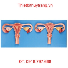 MÔ HÌNH TỬ CUNG VÀ BUỒNG TRỨNG GD/A42001