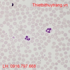 TIÊU BẢN BỆNH HỌC HUYẾT HỌC Ở NGƯỜI