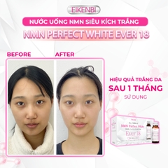 Nước Uống NMN Siêu Kích Trắng NMN Perfect White Ever 18 Eikenbi [10 Chai x 30ml]