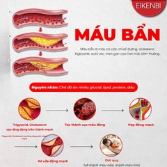 Viên Uống Lumbrokinase EX Eikenbi Tan Cục Máu Đông & Chống Đột Quỵ [60 viên]