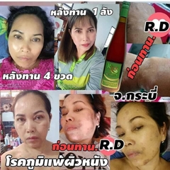 RD Fresh Plus Nước Hoa Quả Enzyme Thái Lan