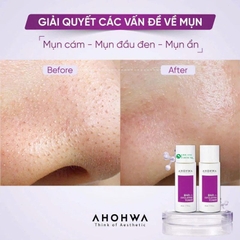 Toner BHA Exfoliating 2% Ahohwa 80ml