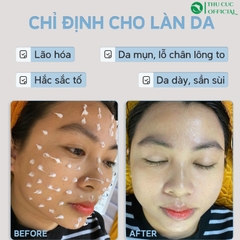 Bộ vi kim tảo biển dạng Kem Desembre Exfoliator 3in1 Peeling Cream