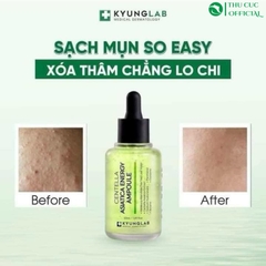 Serum giảm mụn Kyung Lab Acnes Centella Asiatica Ampoule 50ml